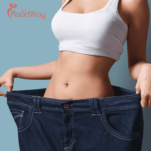 Gastric Sleeve in Turkey: The Complete Guide for UK Weight Loss Patients